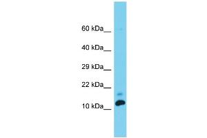 Host: Rabbit  Target Name: Med31  Sample Tissue: Rat Testis lysates  Antibody Dilution: 1. (MED31 抗体  (C-Term))