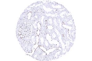 Kidney with moderate to strong nuclear GATA3 positivity of collecting ducts some cells of distal tubuli and of podocytes