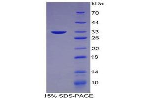 SDS-PAGE (SDS) image for Keratin 5 (KRT5) (AA 163-471) protein (His tag) (ABIN1080149) (Cytokeratin 5 Protein (AA 163-471) (His tag))