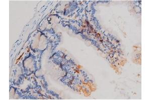 ABIN6267463 at 1/200 staining Mouse intestinal tissue sections by IHC-P.