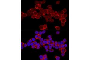 Confocal immunofluorescence analysis of THP-1 cells using CD11a/LFA-1A/ITGAL Polyclonal Antibody (ABIN3015541, ABIN3015542, ABIN3015543, ABIN1680526 and ABIN6218728) at dilution of 1:200.