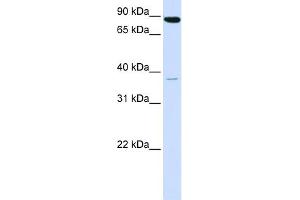 WB Suggested Anti-ACSL3 Antibody Titration:  0. (Acsl3 抗体  (N-Term))