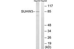 Western Blotting (WB) image for anti-Zinc Finger Protein 280C (ZNF280C) (AA 251-300) antibody (ABIN2890658) (ZNF280C 抗体  (AA 251-300))