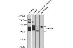 Western blot analysis of extracts of various cell lines, using  antibody  at 1:1000 dilution. (ADAP1 抗体  (AA 1-374))