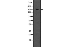 Western blot analysis of LDLR using HeLa whole  lysates. (LDLR 抗体  (Internal Region))