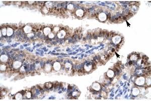 Human Intestine (Zinc Finger with KRAB and SCAN Domains 7 (ZKSCAN7) (N-Term) 抗体)