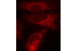 Immunofluorescence staining of methanol-fixed Hela cells using Phospho-YWHAZ-S58 antibody. (14-3-3 zeta 抗体  (pSer58))