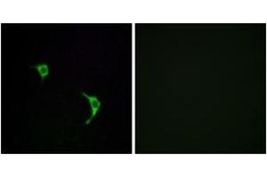 Immunofluorescence analysis of LOVO cells, using SAPK/JNK (Ab-183) Antibody. (SAPK, JNK (AA 166-215) 抗体)