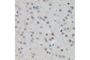 Immunohistochemistry of paraffin-embedded mouse brain using MYCN antibody (ABIN5970179) (40x lens). (MYCN 抗体)