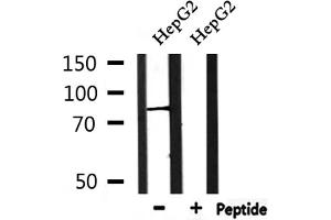 Western blot analysis of extracts from HepG2, using PIGQ Antibody. (PIGQ 抗体  (Internal Region))