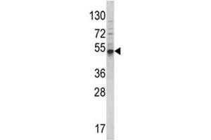 Western Blotting (WB) image for anti-Bone Morphogenetic Protein 3 (BMP3) (AA 8-36) antibody (ABIN3030176)