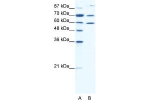 Western Blotting (WB) image for anti-Heat Shock Protein 90kDa alpha (Cytosolic), Class B Member 1 (HSP90AB1) (N-Term) antibody (ABIN2792217)