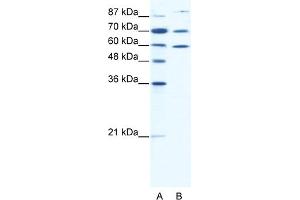 WB Suggested Anti-HSP90AB1 Antibody Titration:  0. (HSP90AB1 抗体  (N-Term))