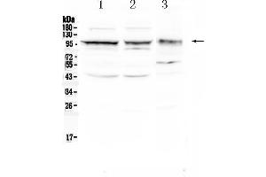 Western blot analysis of CD166/ALCAM using anti- CD166/ALCAM antibody . (CD166 抗体  (AA 167-406))