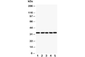 Western blot testing of E2F6 antibody and Lane 1:  HeLa;  2: COLO320;  3: A549;  4: MCF-7;  5: SMMC-7721 cell lysate (E2F6 抗体  (Middle Region))