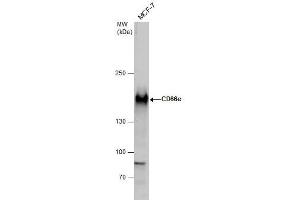 WB Image CD66e antibody detects CD66e protein by western blot analysis. (CEACAM5 抗体)