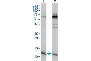 Western Blot analysis of ATPIF1 expression in transfected 293T cell line by ATPIF1 monoclonal antibody (M01), clone 3E2. (ATPase Inhibitory Factor 1 抗体  (AA 1-106))