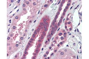 Immunohistochemistry (IHC) image for anti-ATPase, H+ Transporting, Lysosomal V0 Subunit A2 (ATP6V0A2) (N-Term) antibody (ABIN2775376)