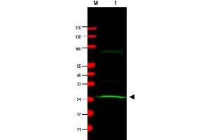 Western Blotting (WB) image for anti-MAD2 Mitotic Arrest Deficient-Like 1 (Yeast) (MAD2L1) antibody (ABIN400793) (MAD2L1 抗体)