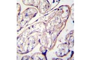 Formalin fixed and paraffin embedded human placenta tissue reacted with PYCR2 Antibody (Center) followed by peroxidase conjugation of the secondary antibody and DAB staining.