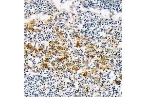 Immunohistochemical analysis of CYSLTR1 staining in human lymph node formalin fixed paraffin embedded tissue section. (CysLTR1 抗体)