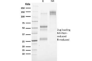 SDS-PAGE Analysis Purified Cytokeratin 3 Mouse Monoclonal Antibody (KRT3/2130). (Keratin 3 抗体)