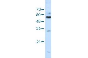 Western blot analysis of Jurkat cell lysate with KHDRBS3 polyclonal antibody . (KHDRBS3 抗体  (AA 281-330))