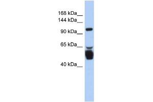WB Suggested Anti-LRRC8B Antibody Titration:  0. (LRRC8B 抗体  (N-Term))
