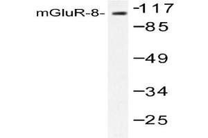 Image no. 1 for anti-Glutamate Receptor, Metabotropic 8 (GRM8) antibody (ABIN265441) (GRM8 抗体)