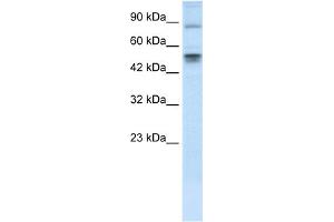 WB Suggested Anti-MDM4 Antibody Titration: 0. (MDM4-binding Protein 抗体  (N-Term))