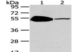 Western Blot analysis of Mouse brain and heart tissue using TSPYL1 Polyclonal Antibody at dilution of 1/200 (TSPYL1 抗体)