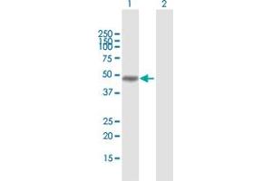 Western Blot analysis of MAGEA8 expression in transfected 293T cell line by MAGEA8 MaxPab polyclonal antibody. (MAGEA8 抗体  (AA 1-318))