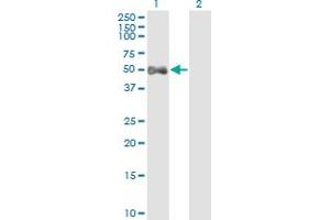 Western Blotting (WB) image for anti-Aldehyde Dehydrogenase 9 Family, Member A1 (ALDH9A1) (AA 173-270) antibody (ABIN513252)
