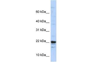 WB Suggested Anti-KIAA0040 Antibody Titration:  0. (KIAA0040 抗体  (Middle Region))