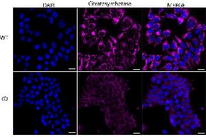 Immunocytochemical staining of HeLa cells using Citrate synthetase antibody (ABIN7798088), 1:1,000), Top panel: wild-type (WT), Bottom panal: Citrate synthetase shRNA knockdown (KD).