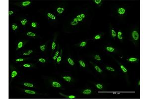 Immunofluorescence of monoclonal antibody to OXSR1 on HeLa cell. (OXSR1 抗体  (AA 351-450))