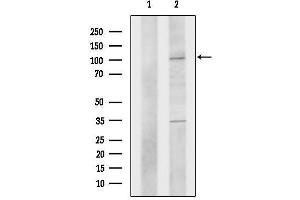 anti-Premelanosome Protein (PMEL) (C-Term) antibody