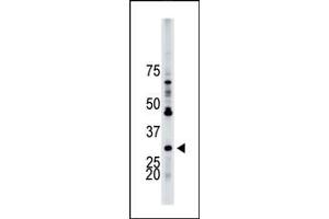 The anti-YWHAB Pab (ABIN1882154 and ABIN2842225) is used in Western blot to detect YWHAB in HL-60 cell lysate. (YWHAB 抗体  (N-Term))