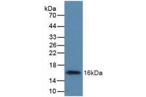 Western blot analysis of recombinant Human UGCG. (UGCG 抗体  (AA 39-171))