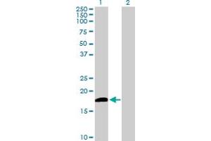 Western Blot analysis of DUSP21 expression in transfected 293T cell line by DUSP21 MaxPab polyclonal antibody. (DUSP21 抗体  (AA 1-190))