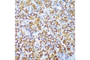 Immunohistochemistry of paraffin-embedded Rat ovary using CYB5R1 Rabbit pAb (ABIN7266630) at dilution of 1:100 (40x lens). (CYB5R1 抗体  (AA 1-305))