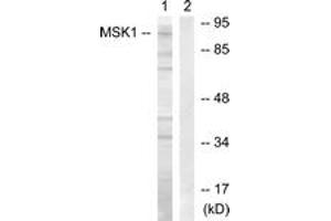 Western blot analysis of extracts from COS7 cells, treated with Sorbitol 0. (MSK1 抗体  (AA 331-380))