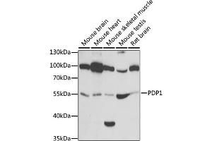 Western blot analysis of extracts of various cell lines, using PDP1 antibody (ABIN6132860, ABIN6145404, ABIN6145405 and ABIN6221944) at 1:1000 dilution. (PDP 抗体  (AA 278-537))