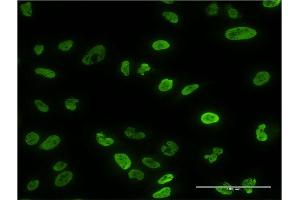 Immunofluorescence of monoclonal antibody to PPP3CA on HeLa cell.