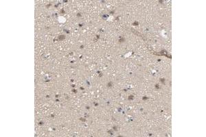Immunohistochemical staining of human cerebral cortex with DYNLT3 polyclonal antibody  shows moderate cytoplasmic positivity in neuronal cells, glial cells. (DYNLT3 抗体)