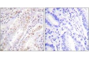 anti-X-Ray Repair Complementing Defective Repair in Chinese Hamster Cells 2 (XRCC2) (AA 211-260) antibody
