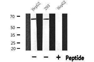 Western Blotting (WB) image for anti-Calreticulin (CALR) (N-Term) antibody (ABIN6256980)