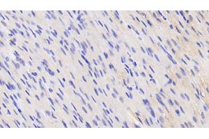 Detection of VCL in Human Cardiac Muscle Tissue using Anti-Vinculin (VCL) Polyclonal Antibody (Vinculin 抗体  (AA 1020-1134))