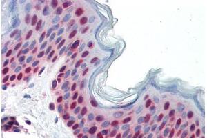 Human Skin (formalin-fixed, paraffin-embedded) stained with PAX7 antibody ABIN462176 followed by biotinylated goat anti-rabbit IgG secondary antibody ABIN481713, alkaline phosphatase-streptavidin and chromogen. (PAX7 抗体  (AA 167-216))