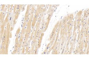 Detection of HIF2a in Human Cardiac Muscle Tissue using Polyclonal Antibody to Hypoxia Inducible Factor 2 Alpha (HIF2a) (EPAS1 抗体  (AA 26-347))